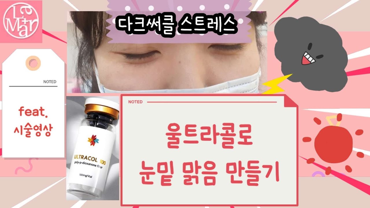 울트라콜 썸네일